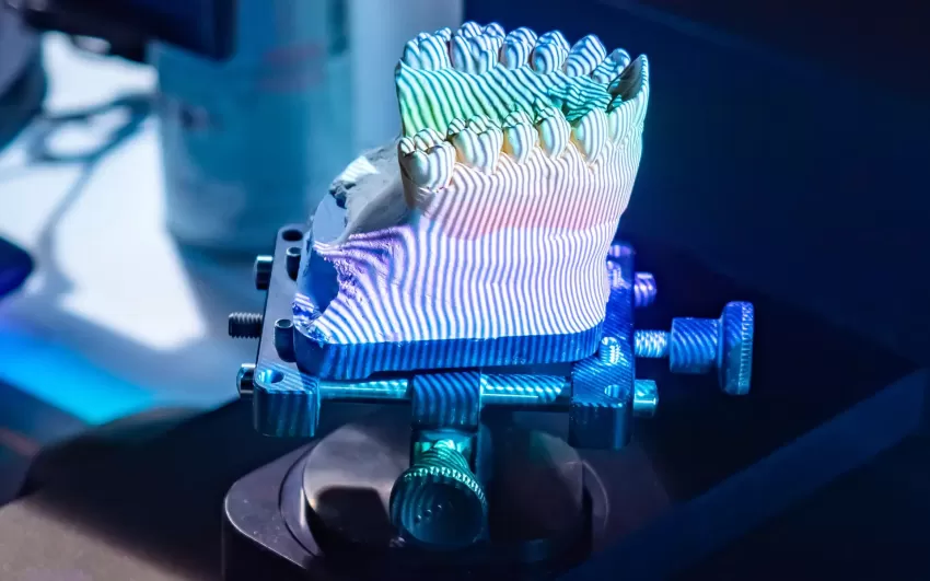dental impression 3d scan