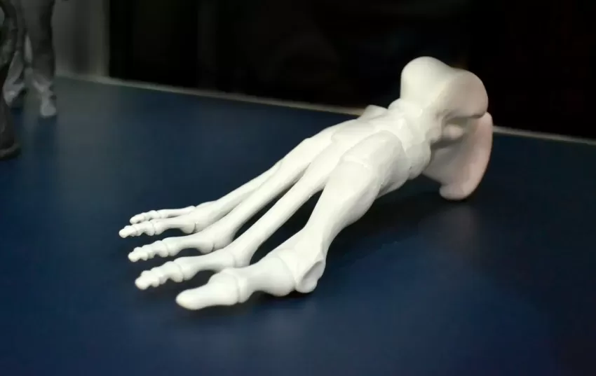 FDM foot prototype